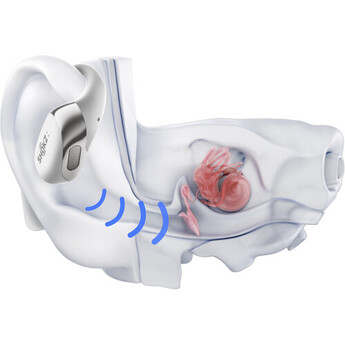 SHOKZ OpenFit 2+ True Wireless Open-Ear Headphones (Gray) — thumbnail 7